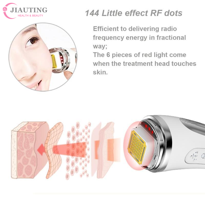 RF Radiofrequentie gezichtslif - Radio Frequency Face Lift Machine recensie en prijs