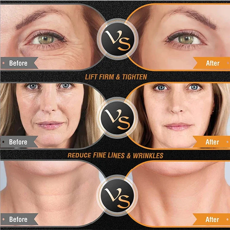 2 in 1 RF Tripolaire Huid Lift - Radio Frequency Face Lift Machine recensie en prijs