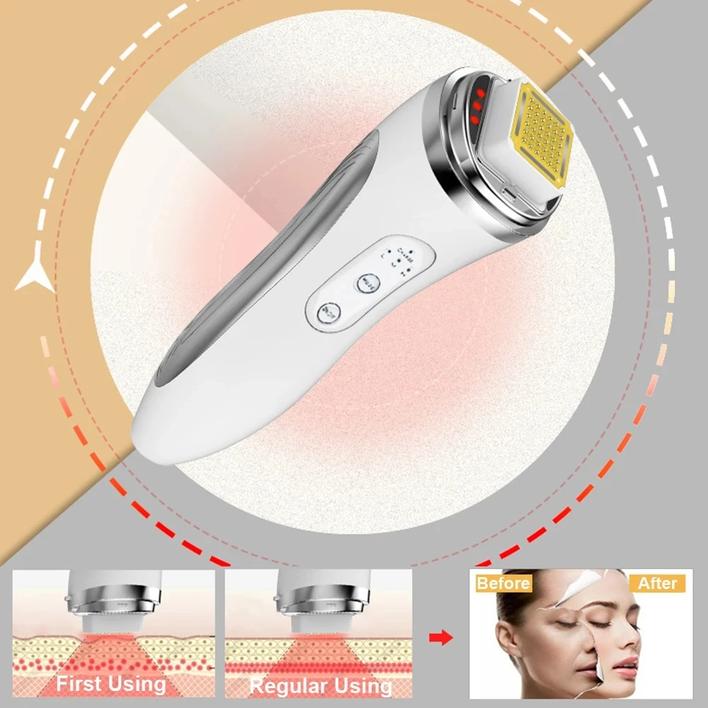 RF Radiofrequentie Gezichtslif - Radio Frequency Face Lift Machine recensie en prijs