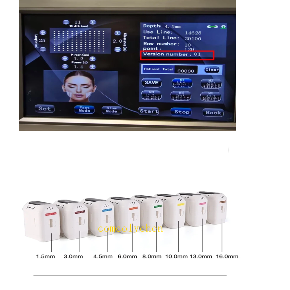 3D/4D HIFU-cartridges vervange - 4D Hifu Machine Skin Tightening recensie en prijs
